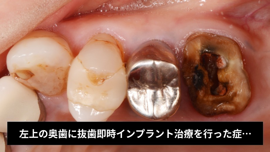 2380-thumbnail.jpg