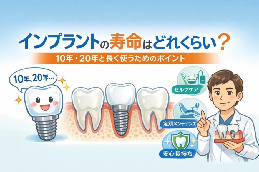 インプラントの寿命はどれくらい？ 〜10年・20年と長く使うために大切なこと〜