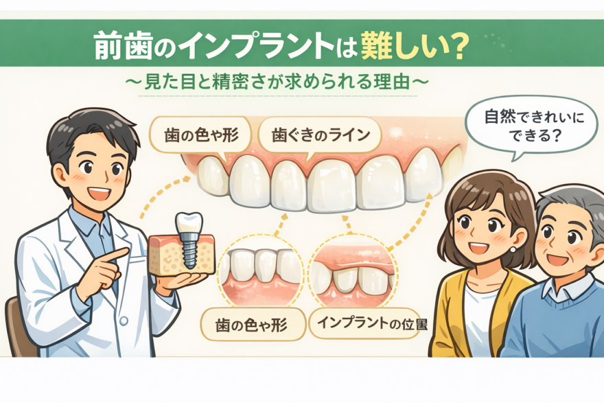 前歯のインプラントは難しい？ 〜見た目と精密さが求められる理由を解説〜